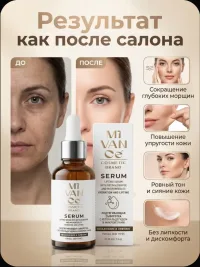 Сыворотка для лица с микроиглами и ретин альдегидом, MIVANCe