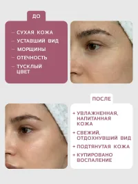 Антивозрастная гидрогелевая лифтинг-маска для лица SAN LIQE (1шт), снижение отечности